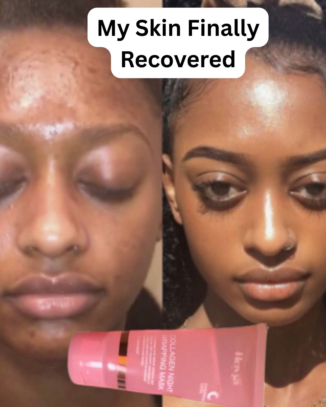 Customer whose skin recovered after using the mask