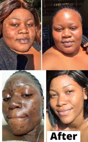 Before and after results from four customers