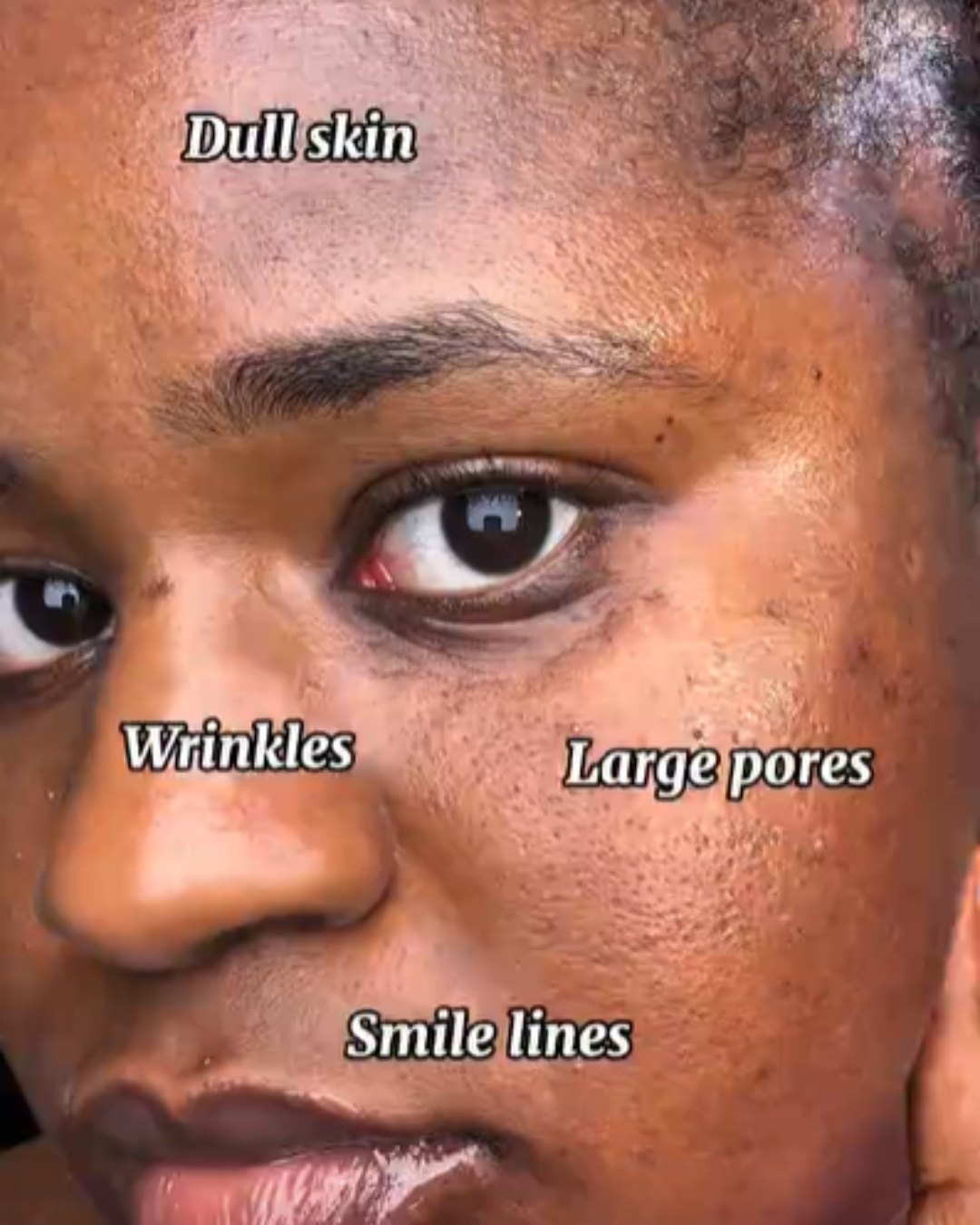 Customer showing dull skin, wrinkles and large pores before using the collagen night mask